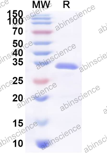 Human TANGO2 Recombinant Protein (N-His)