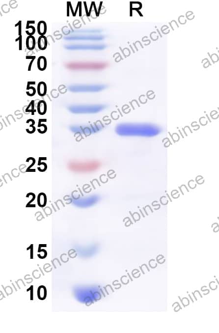 Human SULT1C3 Recombinant Protein (N-His)