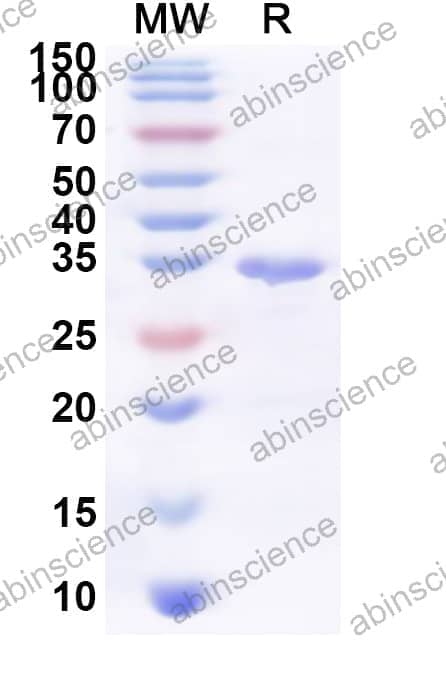 Human USP43 Recombinant Protein (N-His)