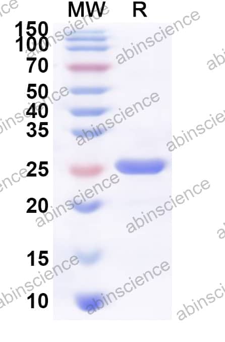 Human FAHD1 Recombinant Protein (N-His)