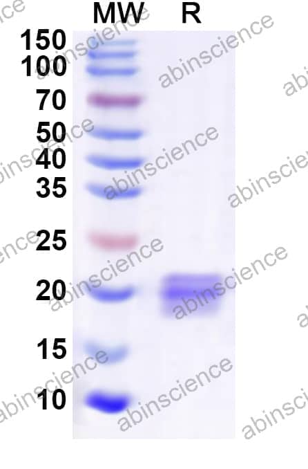 Human UBE2H Recombinant Protein (N-His)
