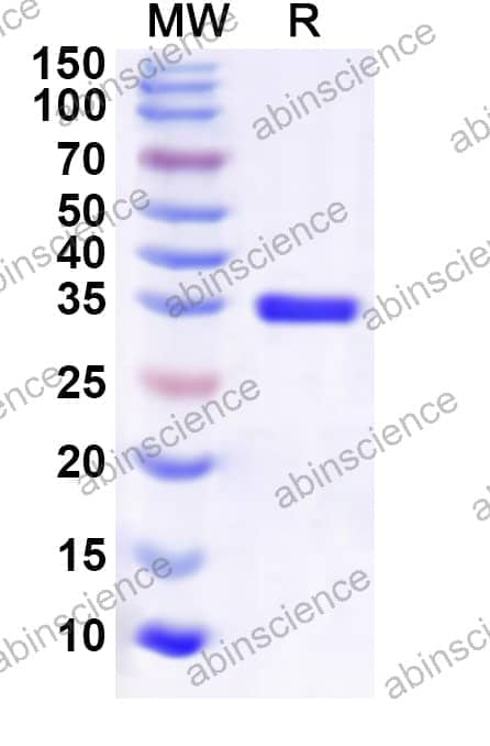 Human CKS1B Recombinant Protein (N-GST & C-His)