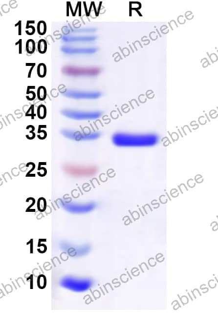 Human UFM1 Recombinant Protein (N-GST & C-His)