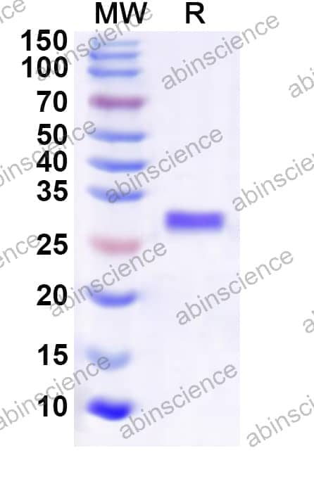 Human IGBP1 Recombinant Protein (N-His)
