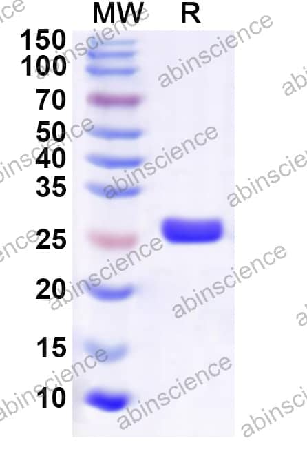 Human ESRRG Recombinant Protein (N-His)