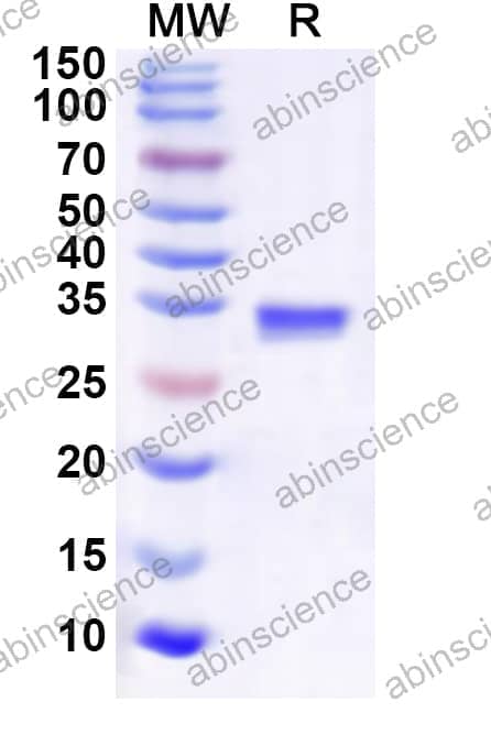 Human RPS28 Recombinant Protein (N-GST & C-His)