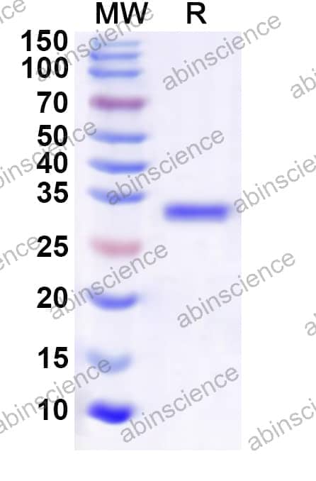 Human RNF4 Recombinant Protein (N-GST & C-His)