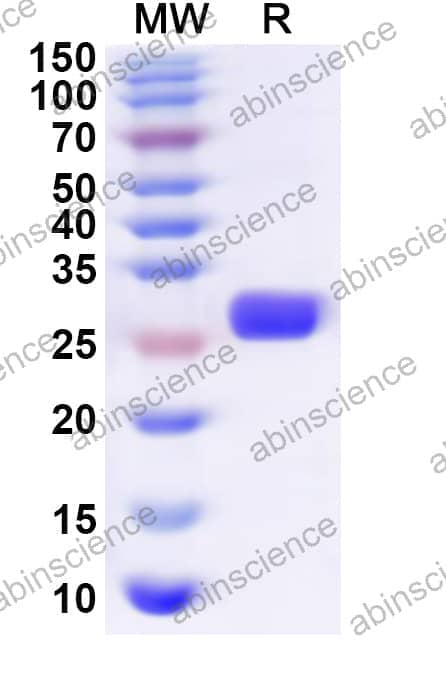 Human PAFAH1B2 Recombinant Protein (N-His)