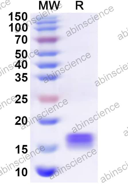 Human TXNL4A Recombinant Protein (N-His)