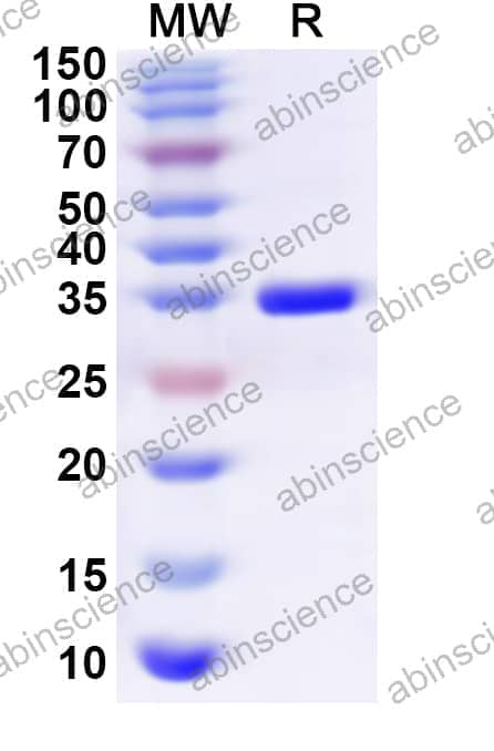 Human SRSF3 Recombinant Protein (N-GST & C-His)