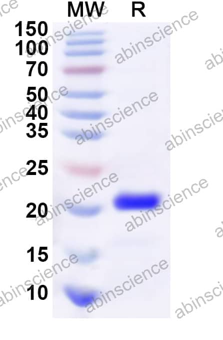 Human SOX4 Recombinant Protein (C-His)