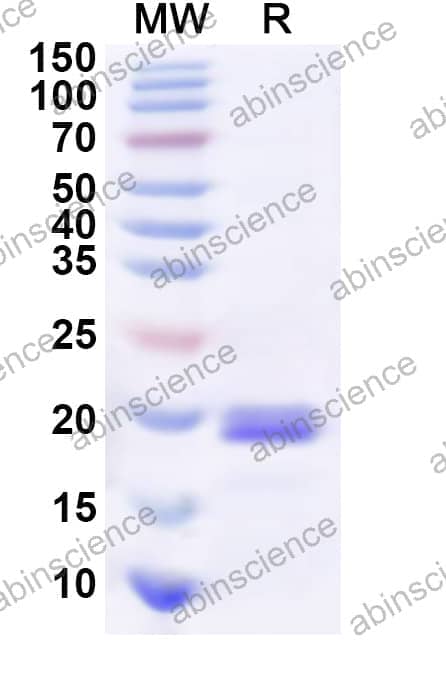 Human COPZ1 Recombinant Protein (N-His)