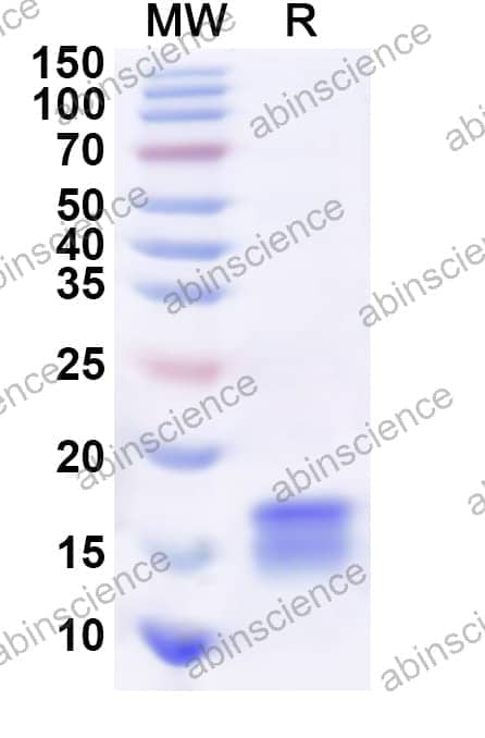 Human CARD17P Recombinant Protein (N-His)