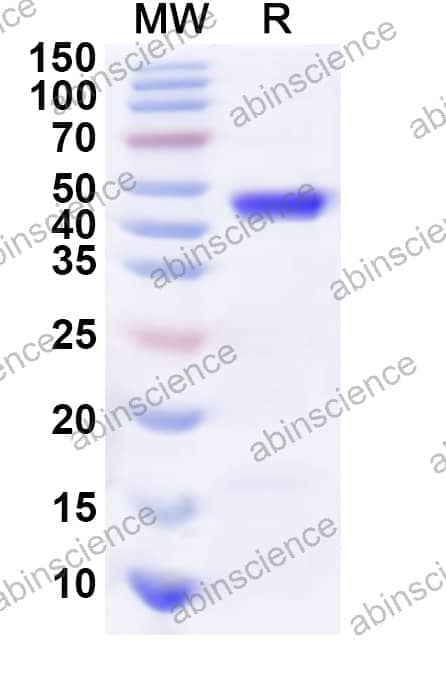 Human APBA1 Recombinant Protein (N-His)