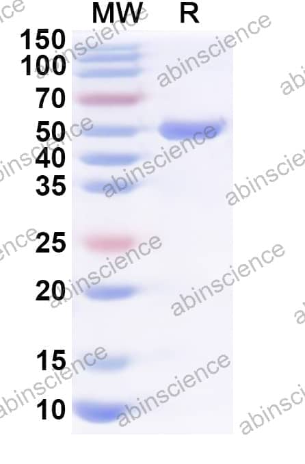 Human KIF23 Recombinant Protein (N-His)