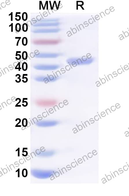 Human MVK Recombinant Protein (N-His)