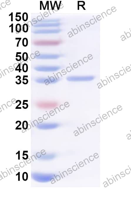 Human H1-1 Recombinant Protein (N-GST & C-His)