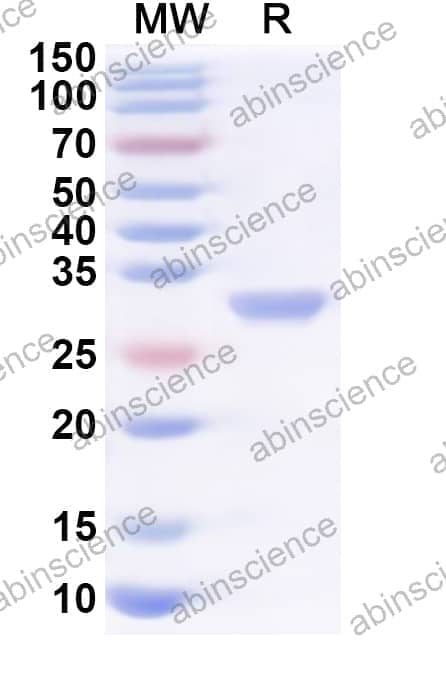 Human KDSR Recombinant Protein (N-His)
