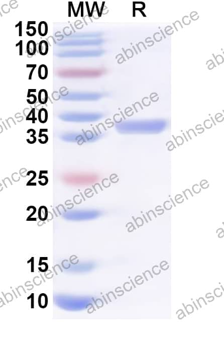 Human REL Recombinant Protein (N-His)