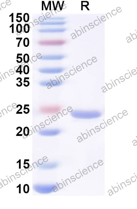 Human HNRNPA0 Recombinant Protein (N-His)