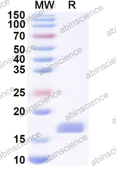 Human LCP2 Recombinant Protein (N-His)