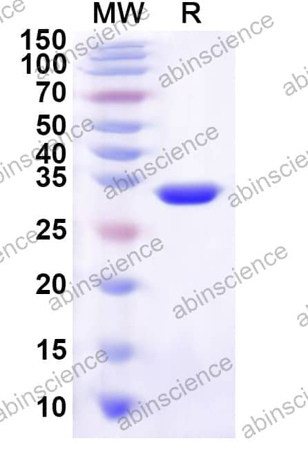 Human MORN3 Recombinant Protein (N-His)
