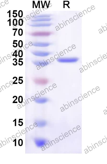 Human WDR82 Recombinant Protein (N-His)