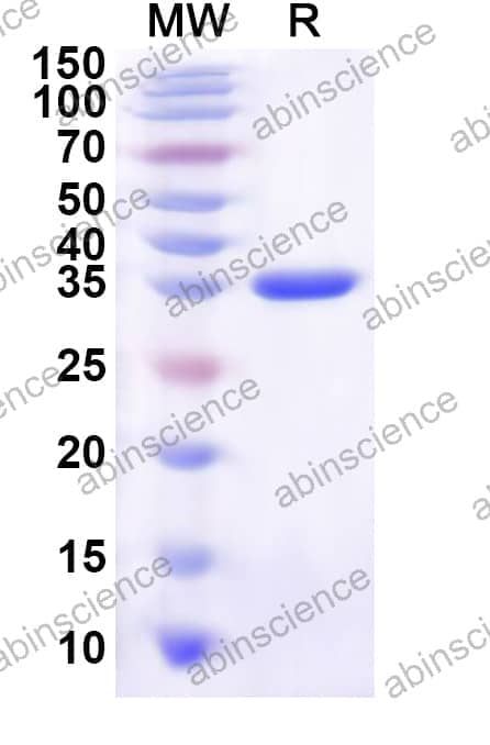 Human ZDHHC24 Recombinant Protein (N-GST & C-His)