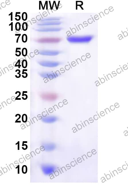 Human PSRC1 Recombinant Protein (N-His-KSI)