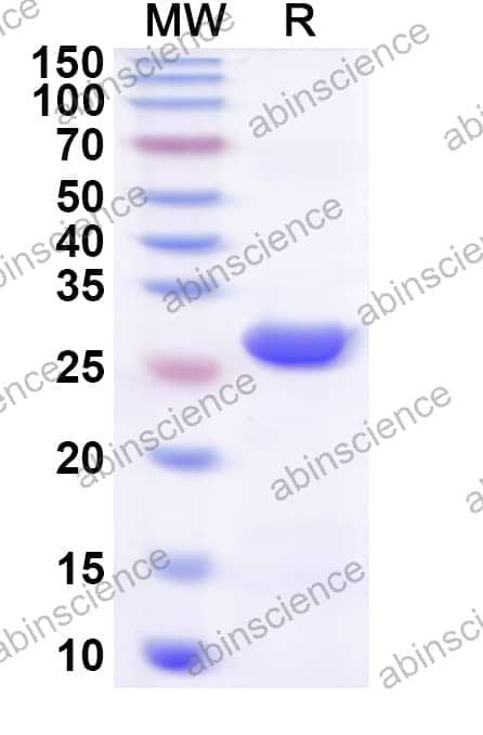 Human SMARCD3 Recombinant Protein (N-His)