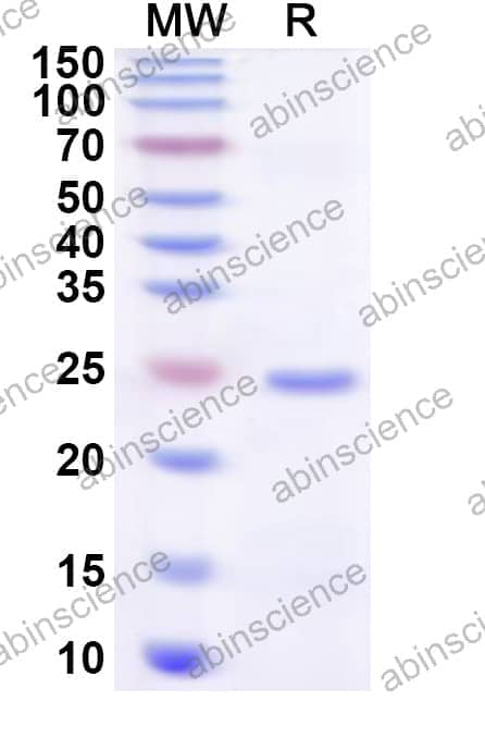 Human ZNF783 Recombinant Protein (N-His)