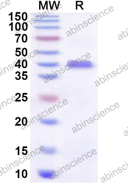 Human ZFP2 Recombinant Protein (N-His)