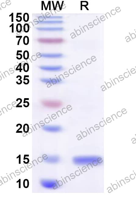 Human BLOC1S2 Recombinant Protein (N-His)