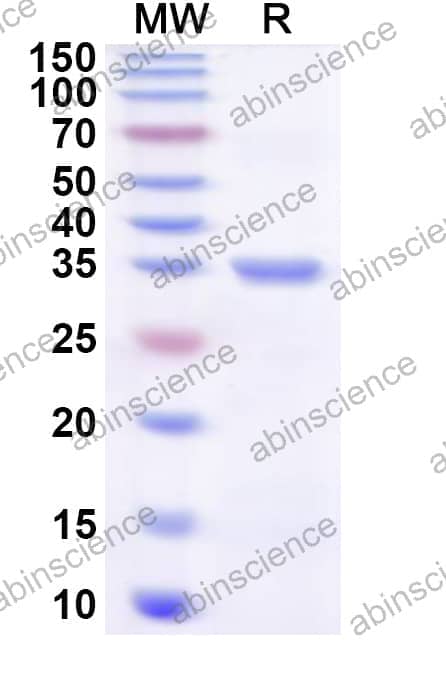 Human GBP6 Recombinant Protein (N-His)