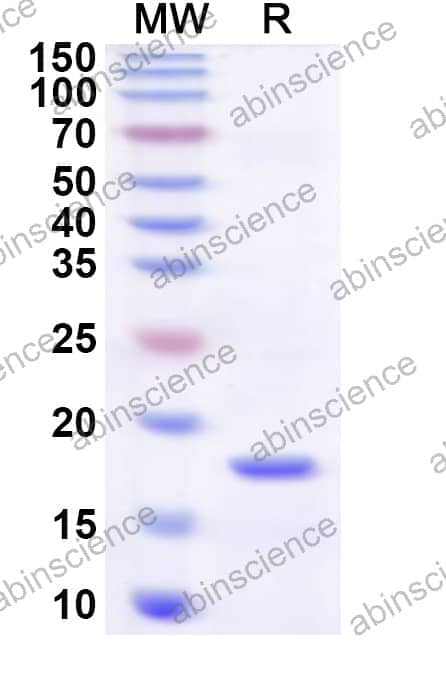 Human ATF7IP Recombinant Protein (N-His)