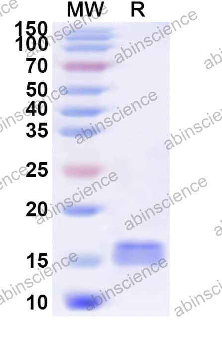 Human SLC30A10 Recombinant Protein (N-His)