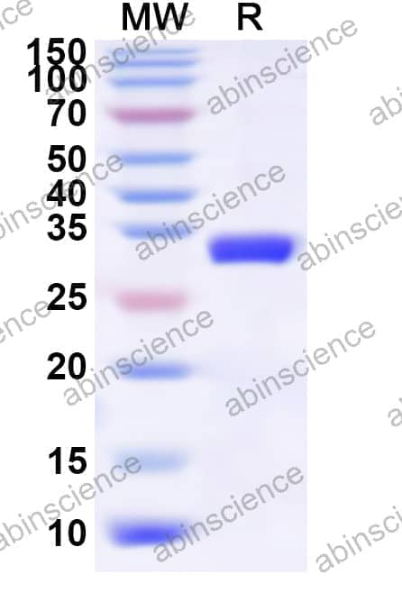 Human TRIM40 Recombinant Protein (N-His)