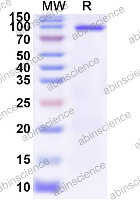 Human PADI6 Recombinant Protein (N-GST & C-His)