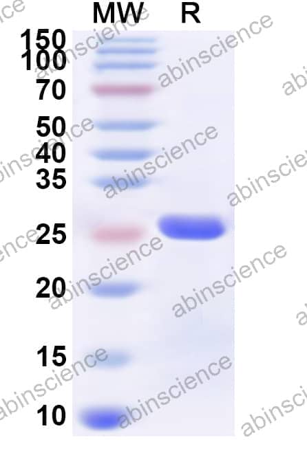 Human ZCCHC12 Recombinant Protein (N-His)