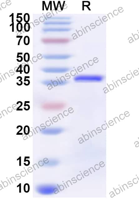 Human ZNF774 Recombinant Protein (N-His)
