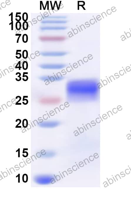Human ZFP1 Recombinant Protein (N-His)