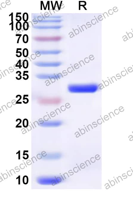 Human MYORG Recombinant Protein (N-His)