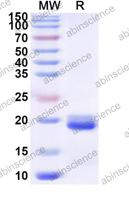 Human TOM1L2 Recombinant Protein (N-His)