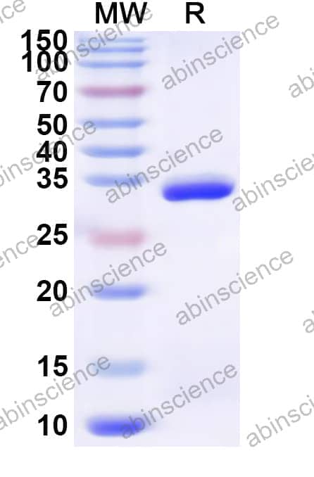 Human TRMT10B Recombinant Protein (N-His)