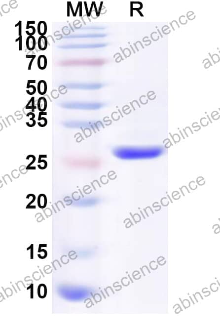 Human COPS5 Recombinant Protein (N-His)