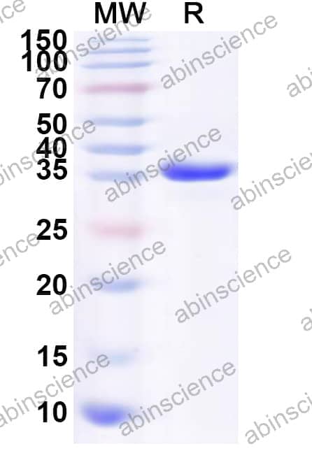 Human DTX2 Recombinant Protein (N-His)