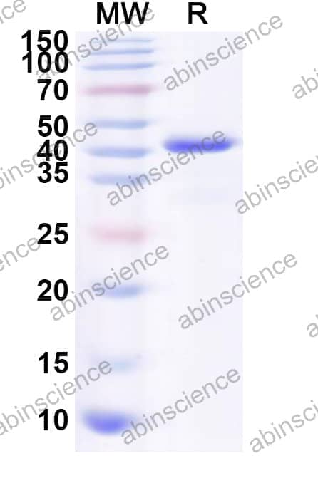 Human CHI3L2 Recombinant Protein (N-His)