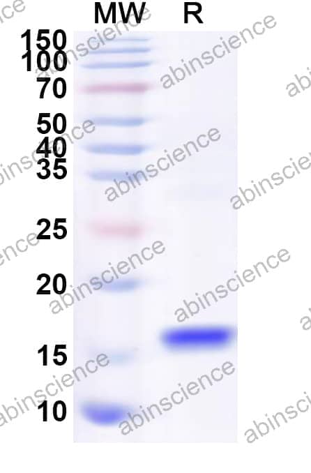 Human CALHM4 Recombinant Protein (N-His)