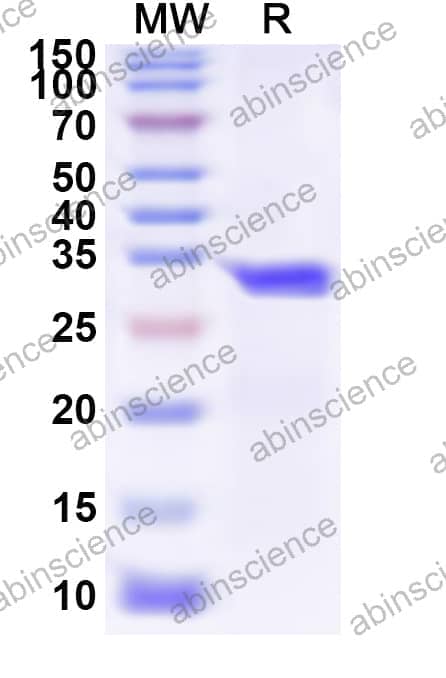 Human ATG10 Recombinant Protein (N-His)