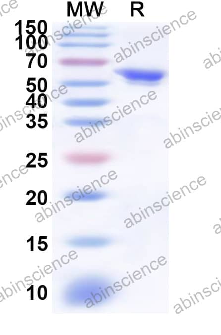 Human ITK Recombinant Protein (N-His)